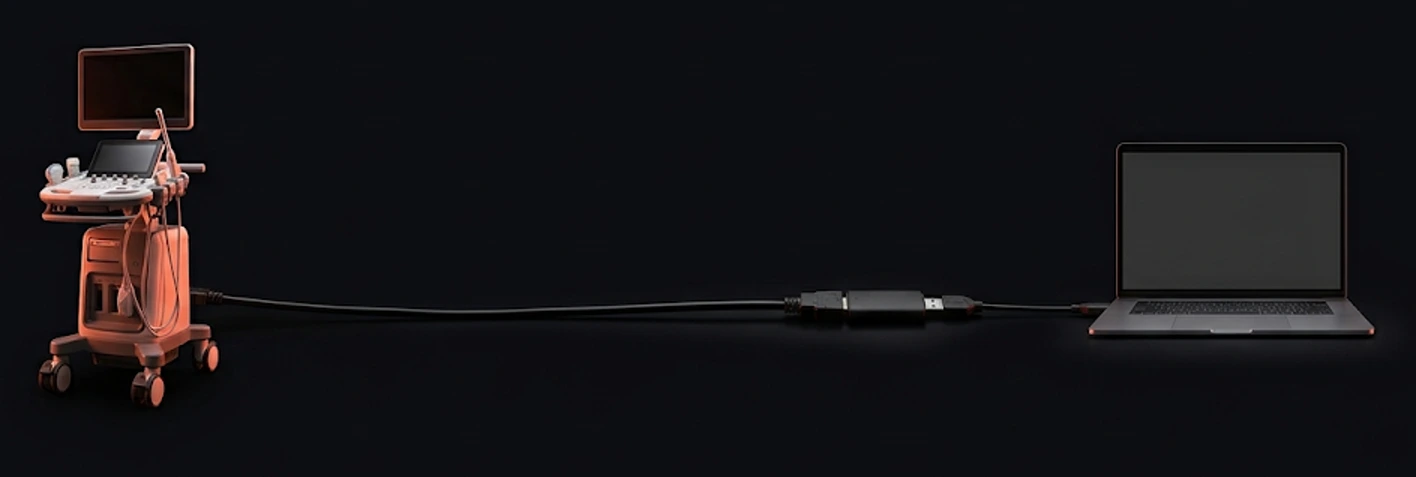 Illustrative render: ultrasound machine, HDMI cable, USB capture card, clinic PC